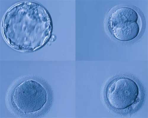 代怀孕哪家最靠谱_代怀好吗,卵子长相不好临床上意味着什么呢?对“试管婴儿”